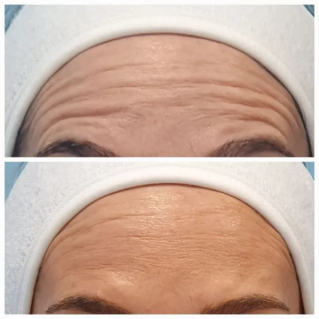 Medicina Estética Facial Sada tratamiento