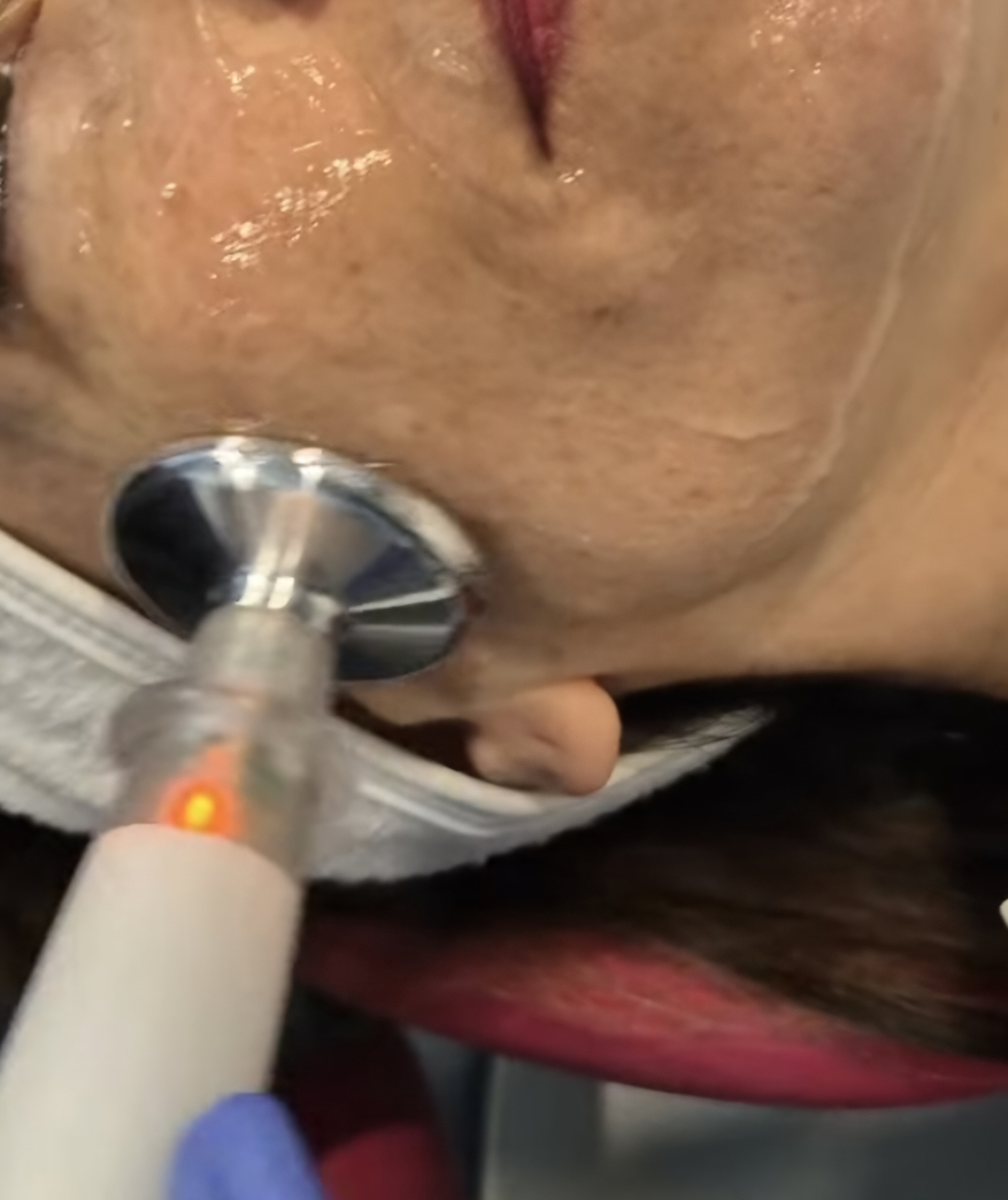 Medicina Estética Facial Sada tratamiento