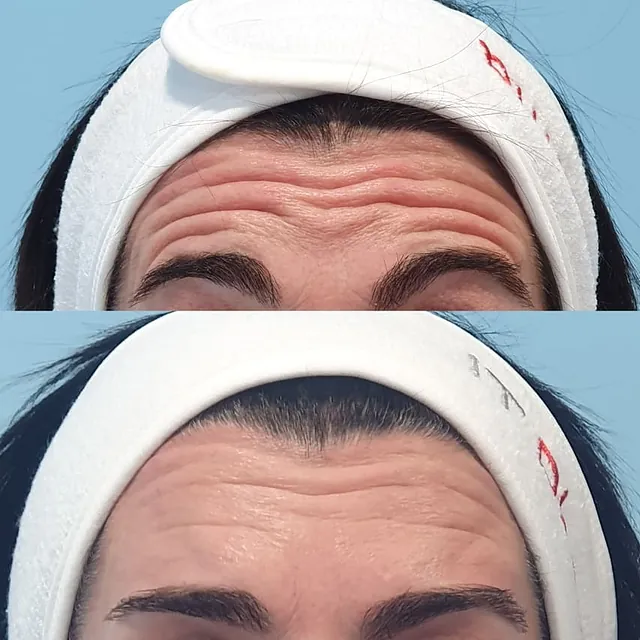 Medicina Estética Facial Sada tratamiento